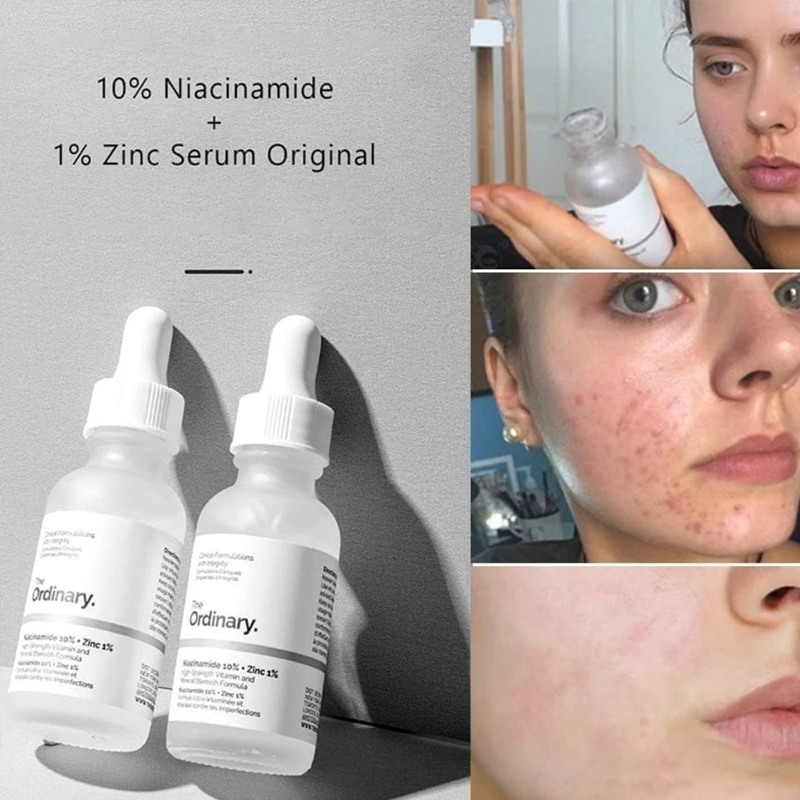 เซรั่ม The Ordinary Niacinamid - Luxury Skincare Brands บทวิจารณ์และราคา